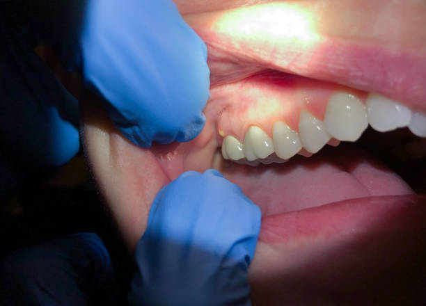 Best Emergency Dentist for Knocked-Out Tooth in Ford City, PA
